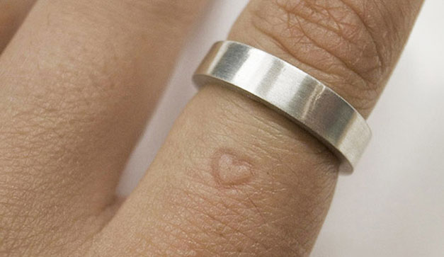 Anillo